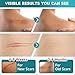 Pumkot Silicone Scar Sheets Silicone Scar Tape18 x 157 Roll4M Medical Grade Scar Removal Away Strips for Surgical Scars Keloid CSection Burn Stickiness Upgrade Waterproof Reusable - Image 4