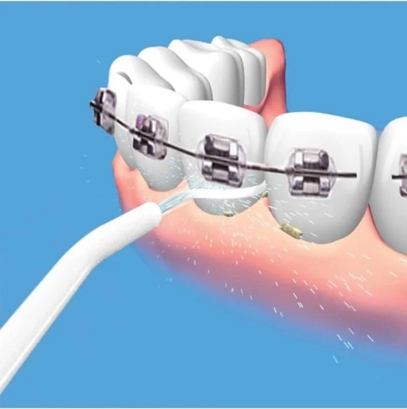 Lisinya Portable Portable Dental Floss Power Floss | Easy and Effective Teeth Cleaning | Water Jet Technology ( )
