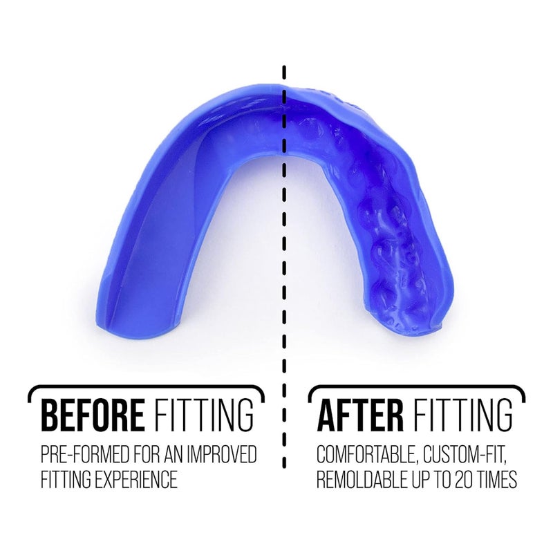 Sisu 3D Mouthguard  Hot Pink - 2.0Mm Thin - For Athletes Over 5 Tall - Pre-Formed For Custom-Molded Fit - Remoldable Up To 20 Times - Non Toxic - Image 5