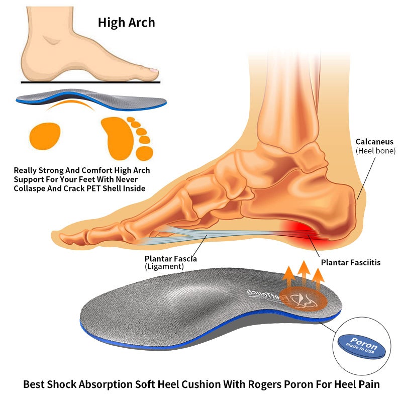 FeetTouch Strong Arch Support Orthotics for Metatarsalgia Morton's Neuroma,Ball of Foot Pain Relief Inserts Plantar Fasciitis Flat Feet with Poron Heel Cushion Grey - Image 2