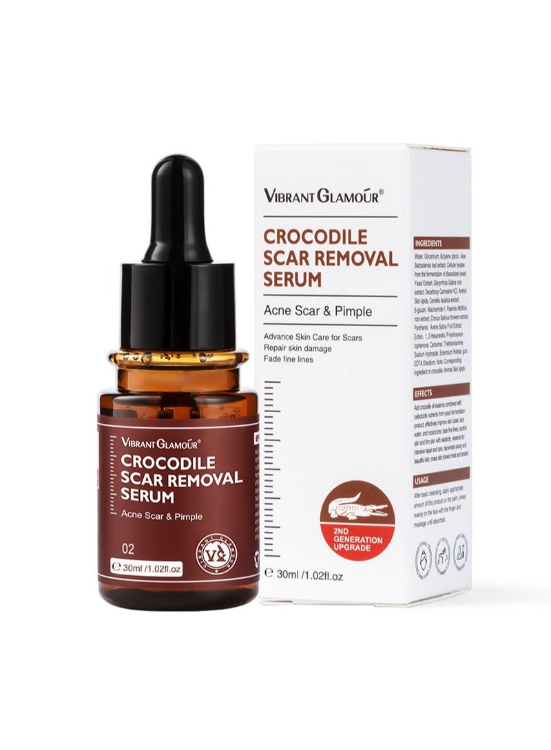 Vibrant Glamour 30ml Crocodile scar removal serum, crocodile scar removal serum, pigmented acne treatment stretch mark removal - Image 1