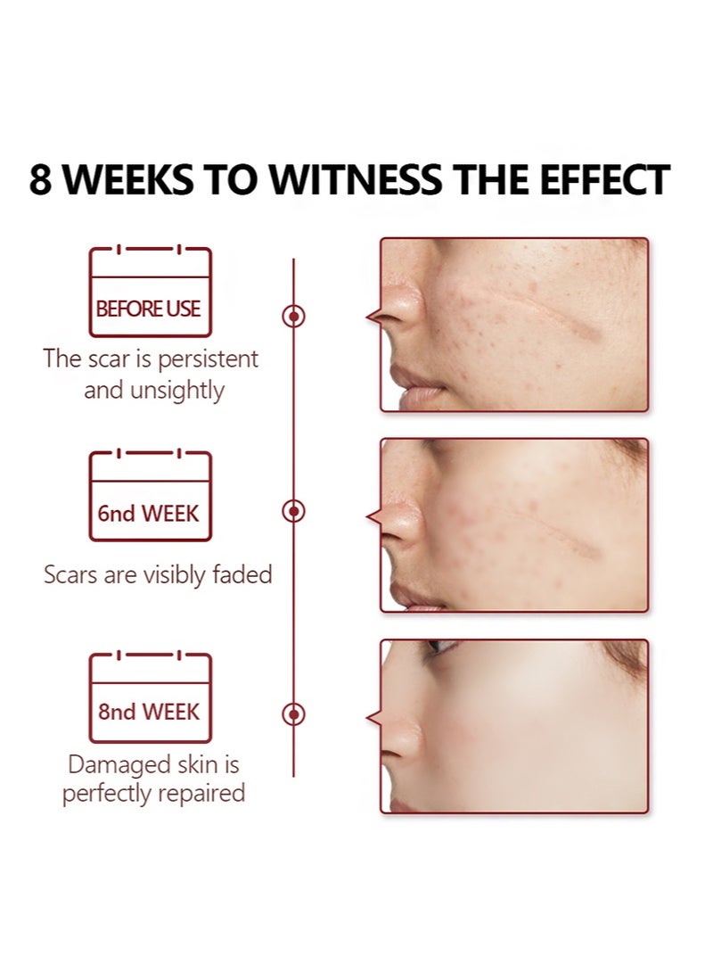 Vibrant Glamour 30ml Crocodile scar removal serum, crocodile scar removal serum, pigmented acne treatment stretch mark removal - Image 4