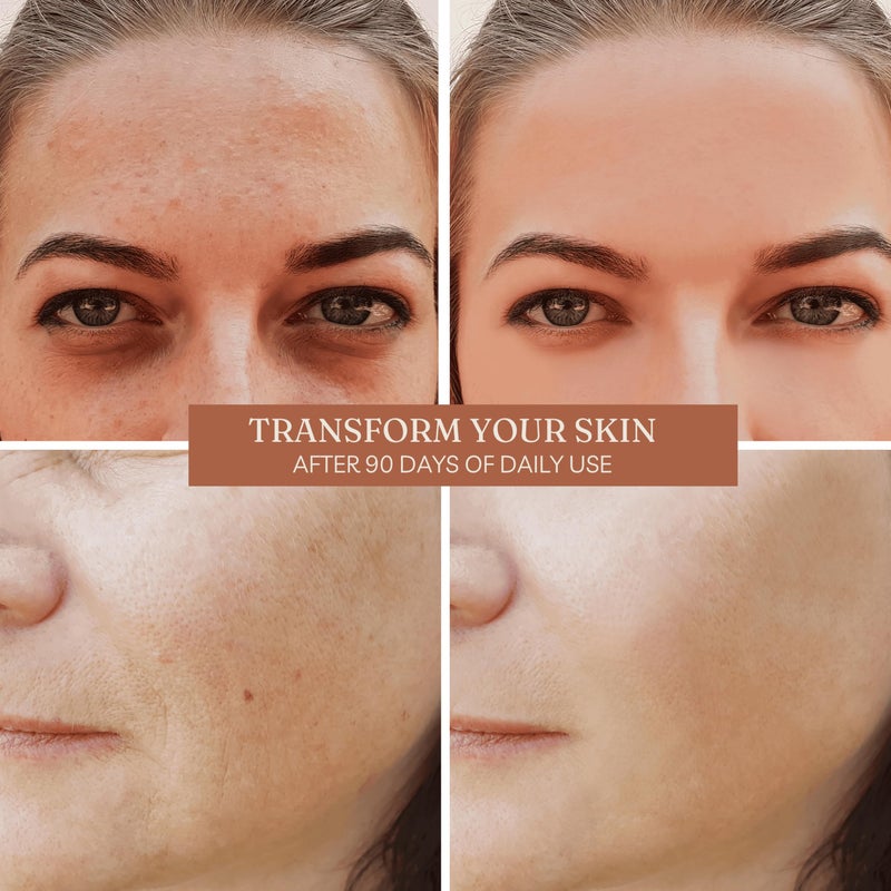 Offernova Organic Rosa de Mosqueta Oil- USDA Certified Rosehip Seed Oil Pure Cold Pressed, Repairs & Brightens Skin - Gua Sha Massage, Face, for All Skin Types - Aceite Facial 1OZ - Image 4