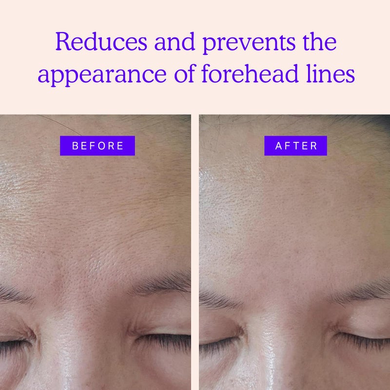 Blumbody Forehead Wrinkle Patches - Anti Wrinkle Facial Patches to Smooth Eyes & Forehead Wrinkles - Non-Silicone Face Tape for Fine Wrinkles between Eyes & Face - 50 Patches (Up to 60 day supply) - Image 2