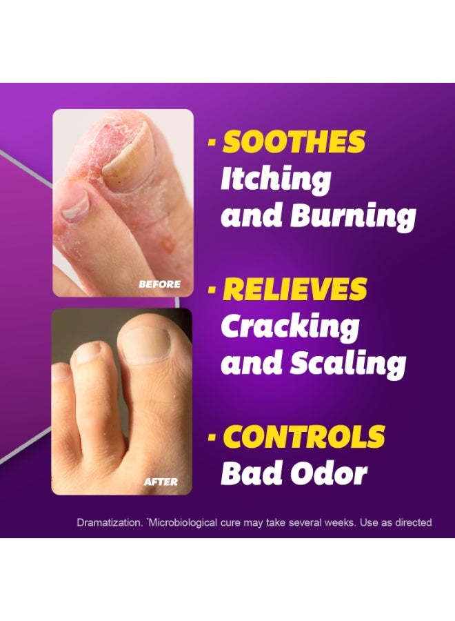 SILKA Anti-Fungal Cream - Image 3