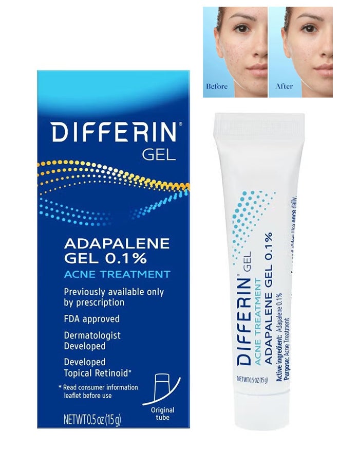 differin Acne Treatment Gel 15g, Treatment for Face with 0.1% Adapalene, Gentle Skin Care for Acne Prone Sensitive Skin - Image 1
