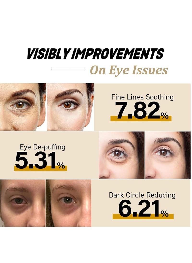 Hoygi - Eye Cream for Dark Circles, Advanced Snail Repair Eye Stick with Snail Mucin, Hydrating Cream for Puffiness and Bags Under Eyes, Reduces Fine Lines and Wrinkles (1pc) - Image 1