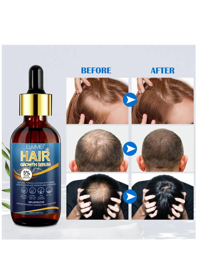 Elaimei - 60ml Hair Growth Serum Natural Hair Regrowth Serum Essence 5% Biotin Minoxidil Hair Serum for Hair Loss Treatment Stronger Thicker Longer Hair Beard Growth Oil Herbal Hair Growth Oil - Image 1