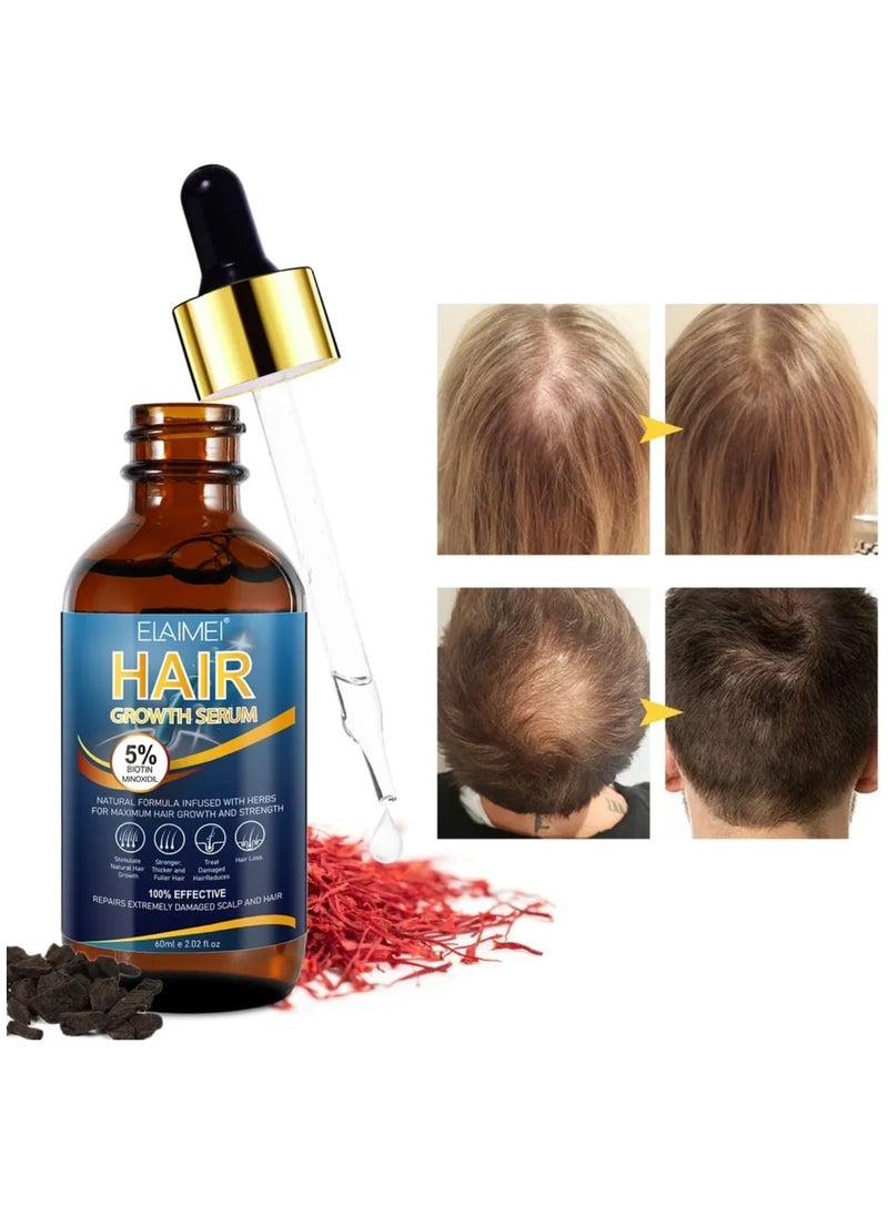 Elaimei - 60ml Hair Growth Serum Natural Hair Regrowth Serum Essence 5% Biotin Minoxidil Hair Serum for Hair Loss Treatment Stronger Thicker Longer Hair Beard Growth Oil Herbal Hair Growth Oil - Image 1