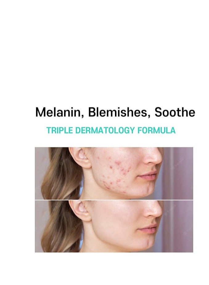 كارنل علاج الميلاسما لكريم الوجه - إزالة البقع الداكنة Centella Asiatica - منتجات العناية بالبشرة الكورية 40ml/1.35 fl.oz - Image 4