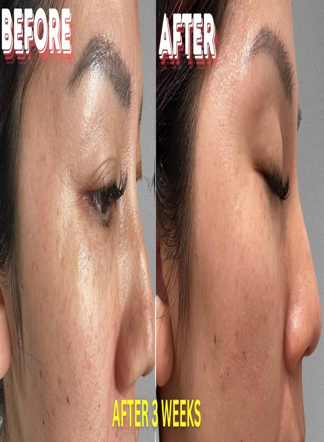 Enspri 4XPeptide Plus Serum Collagen Boosting Anti-Aging Esthetician Collagen Boost for Face, Skin Facial Smooth Wrinkles and Fine Lines Skincare - Image 5