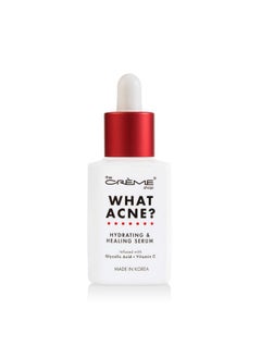 The Crème Shop Korean Skin Care | What Acne? - Hydrating & Healing Vitamin C Serum for Acne Treatment, Dull Skin, irritation, Restoring, Calming, Pore Tightening - pzsku/ZCC3C6C5DCCD03C100A24Z/45/_/1737032171/83956b53-d5e3-4ad5-a0d9-d1f6d6ed35da