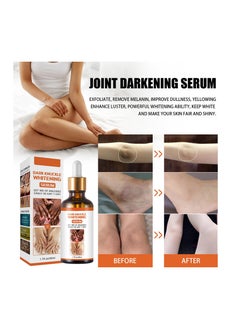 EELHOE Dark Knuckle Whitening Suitable for Relieving Finger Joint Pain Removing Melanin and Moisturizing the Skin  - Image 5