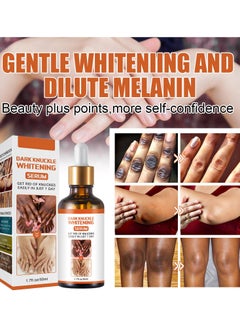 EELHOE Dark Knuckle Whitening Suitable for Relieving Finger Joint Pain Removing Melanin and Moisturizing the Skin  - Image 2