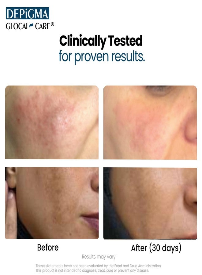 GlocalCare جلوكالكير ديبجما يدعم تقليل فرط التصبغ والكلف والبقع الداكنة بفضل الجلوتاثيون ومستخلصات نبات السرخس وبذور العنب والقطيفة - Image 3