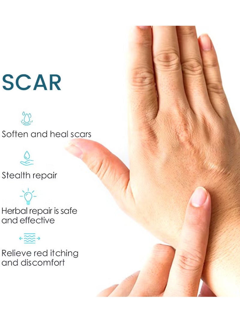 Sumifun كريم العناية بالبشرة باللافندر - كريم إصلاح الندبات للحروق والندبات الناتجة عن التمدد وندبات حب الشباب والندبات القديمة - مهدئ مع infusion اللافندر لاستعادة البشرة - كريم إزالة الندبات وندبات التمدد 20 جرام - Image 2