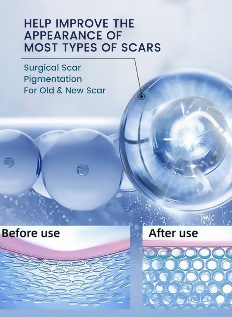 Sumifun كريم العناية بالبشرة باللافندر - كريم إصلاح الندبات للحروق والندبات الناتجة عن التمدد وندبات حب الشباب والندبات القديمة - مهدئ مع infusion اللافندر لاستعادة البشرة - كريم إزالة الندبات وندبات التمدد 20 جرام - Image 5