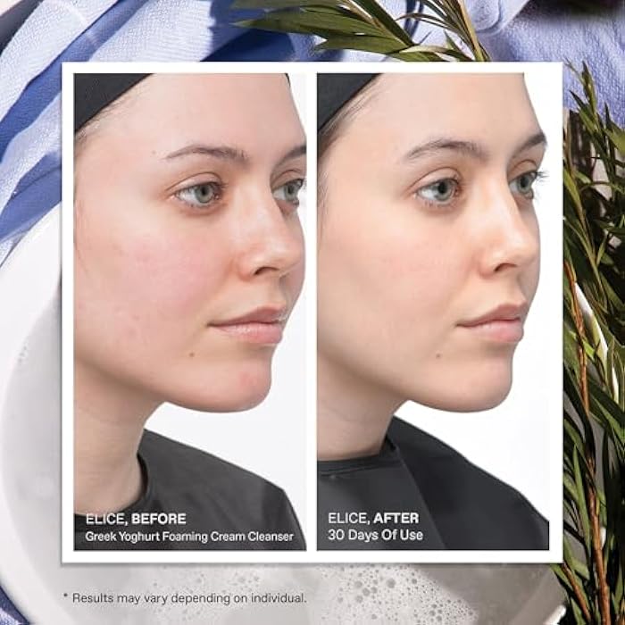 KORRES Greek Yoghurt Foaming Cream Cleanser, Hydrating, Deep Cleansing Skin Care, Makeup Remover, Face Wash for Women, Cream to Foam Facial Cleanser for Dry, Oily, Sensitive, Any Skin Type, 5.07 fl oz - Image 5