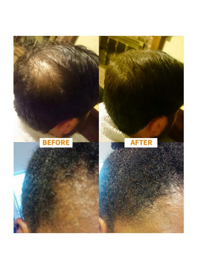 Nor1 Keratin Hair Building Fibers: Hair Fiber Filler and Thickener for Men and Women - Cover Up and Concealer for Thinning Areas or Minor Bald Spot - Thicker, Fuller Hair in Seconds - 25 grams - Image 5