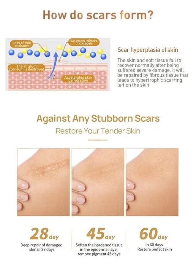 LANBENA Skin Care Gel, Herbal repair scar cream 30g, scar gel, skin repair gel, natural plant ingredients, effectively repair old and new scars, burns, stretch marks, acne, sunburn, 30g - Image 3