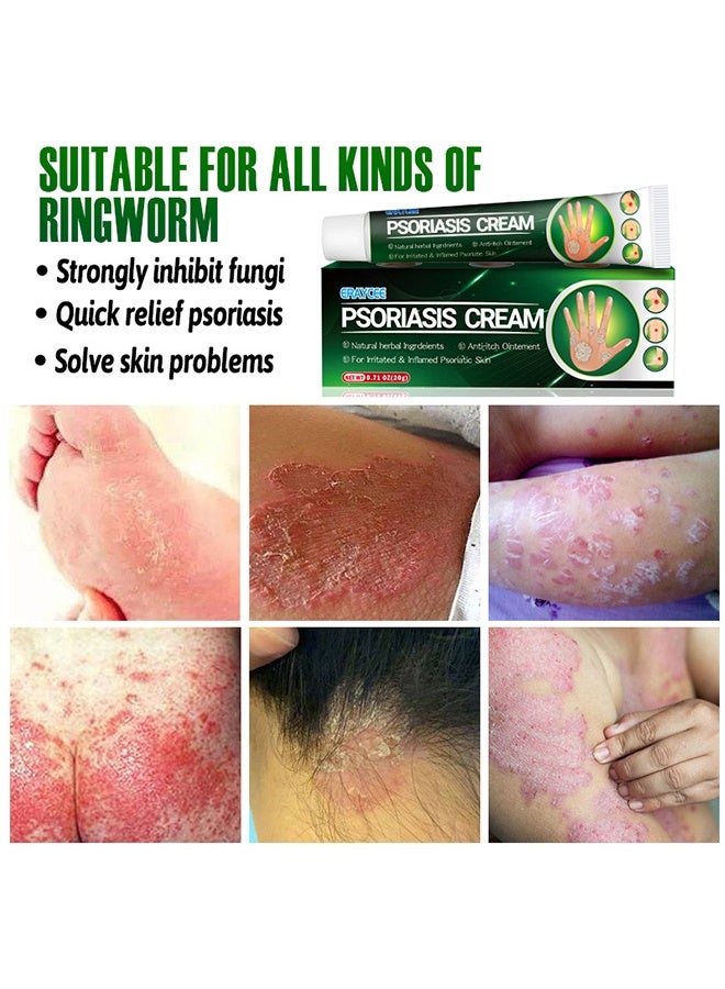 ERAYCEE Psoriasis Cream, Anti-Itching Dermatitis Herbal ointment, Powerfully Inhibits Fungi ,quickly relieves psoriasis, suitable for itching all over the body 20G - Image 3