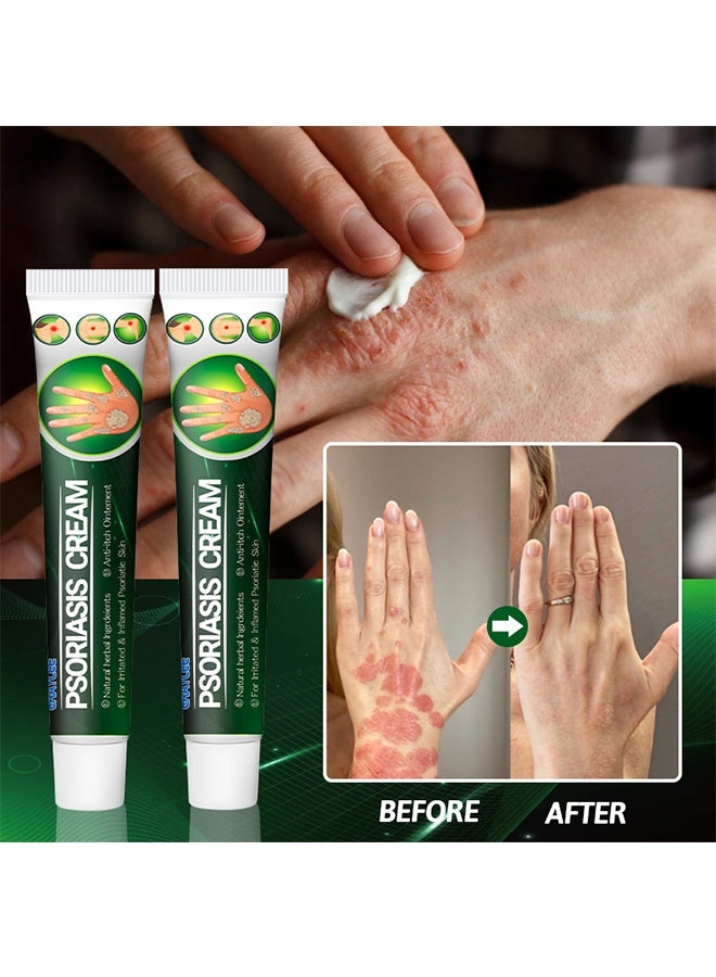 ERAYCEE Psoriasis Cream, Anti-Itching Dermatitis Herbal ointment, Powerfully Inhibits Fungi ,quickly relieves psoriasis, suitable for itching all over the body 20G - Image 5