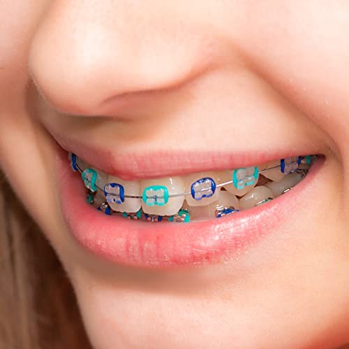 Annhua Orthodontic Ligature Ties Braces Color Bands 1040 PCS, Annhua ​Dental Orthodontic Elastomeric O-Rings Braces Rubber Bands for Braces Brackets - Image 4