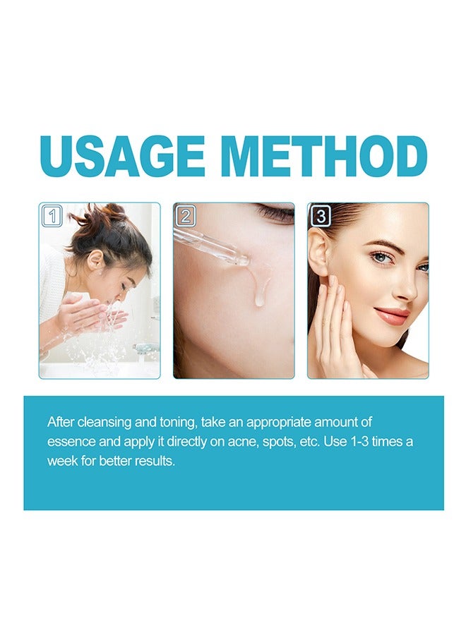 BIOAQUA Acne Removal Essence, Brightening Treatment Serum,Face Serum for Sensitive Skin and Acne 30ml  - Image 5