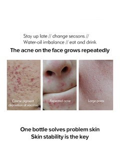 BIOAQUA Acne Removal Essence, Brightening Treatment Serum,Face Serum for Sensitive Skin and Acne 30ml  - Image 3