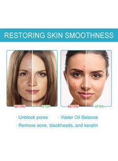 BIOAQUA Acne Removal Essence, Brightening Treatment Serum,Face Serum for Sensitive Skin and Acne 30ml  - Image 4