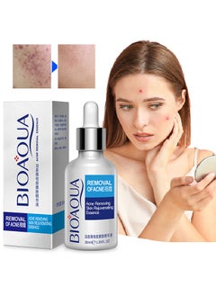 BIOAQUA Acne Removal Essence, Brightening Treatment Serum,Face Serum for Sensitive Skin and Acne 30ml  - Image 1