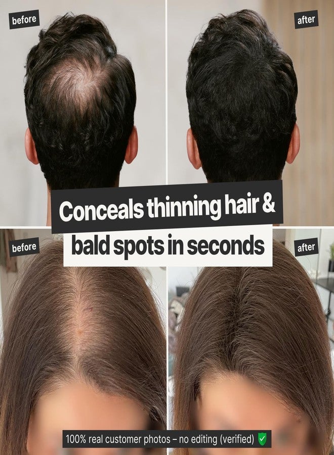 IMPERIO Hair Building Fibers for Thinning Hair - 26g Premium Hair Fibers for Women & Men in Hairdresser Quality - Hair thickening in less than 20 seconds (Black) - Image 3