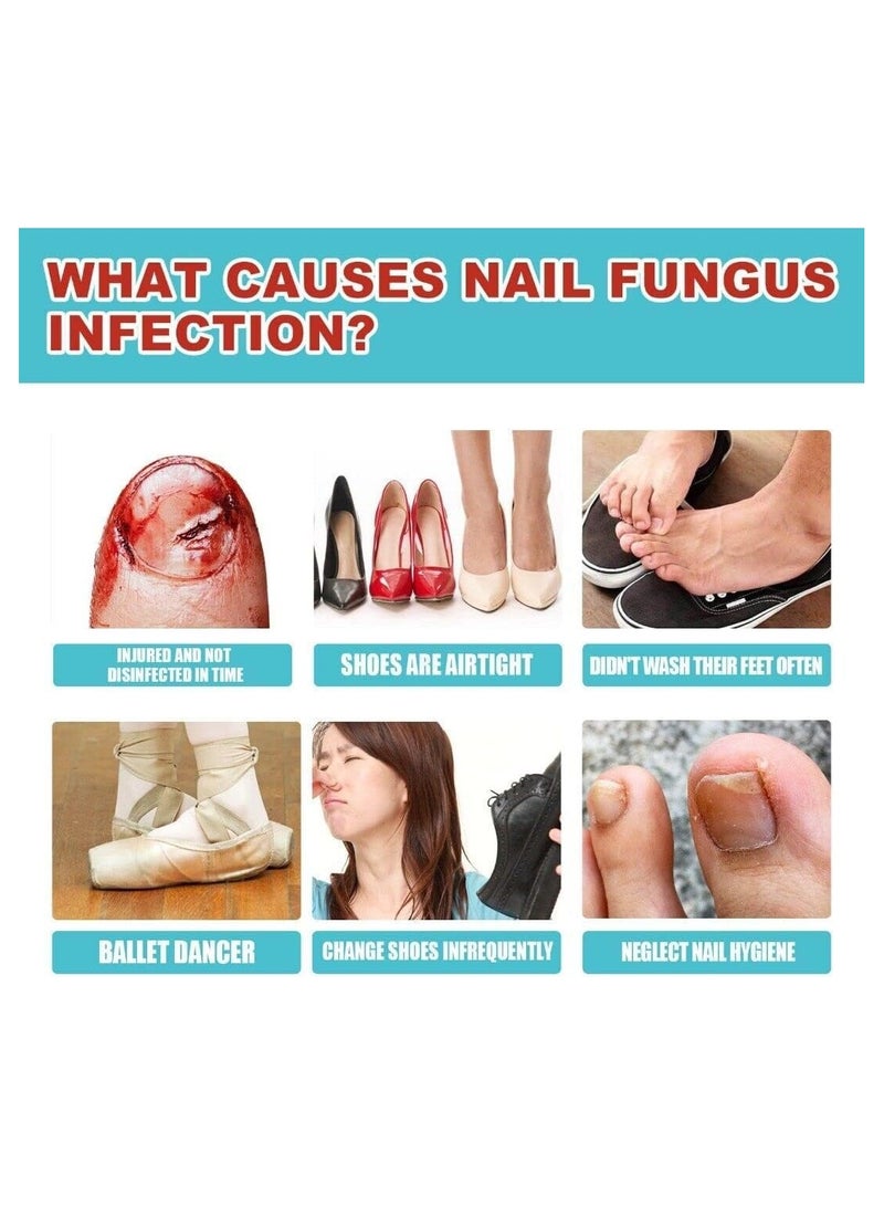 General Antifungal Nail Treatment Patch, Toe Fungus Onychomycosis Repair S-ticker (Pack of 2)  - Image 4