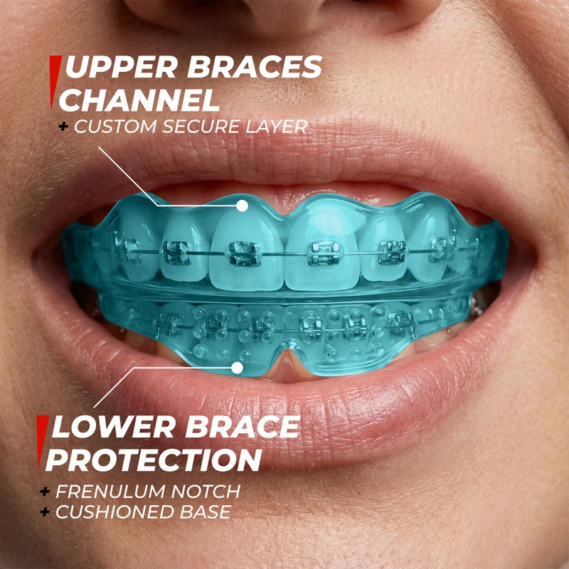 SAFE GRIN Mouth Guard for Sports - Premium Silicone Upper & Lower Teeth Protection - Football, Lacrosse, Hockey, Baseball - Fit for Youth and Teens (Blue, MouthGuard for Braces) - Image 3