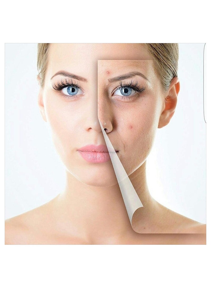 Facial Treatment Micro Needle  Roller (0.5mm) - Image 3