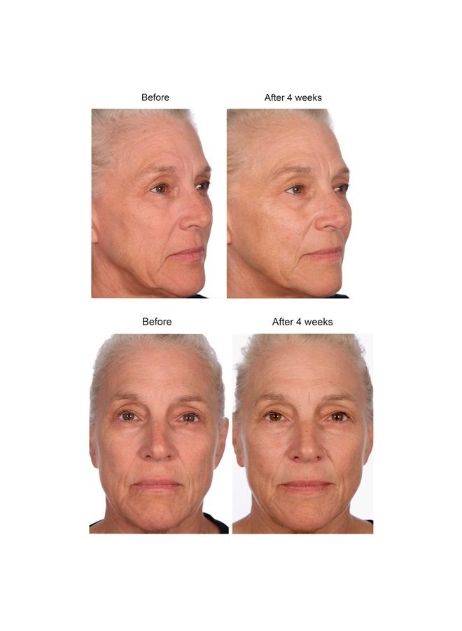 Serious Skincare سيروم مركز لتقليل التجاعيد العميقة من اللؤلؤ الأسود - يعزز تجديد خلايا البشرة - لؤلؤ أسود تاهيتي، بولي ببتيدات، وكافيار أسود - معادن بحرية - 1 أونصة (1 عبوة) - Image 3