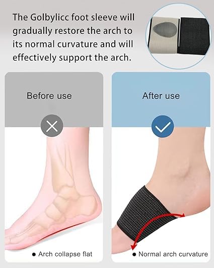 ZIVIK Flat Foot Arch Support for Men & Women | Medial Arch Support for Flat Feet Correction Sleeve with Cushion | Plantar Fasciitis Leg Pain Relief Product | Foot Care for Orthopedic Shoes Slippers, Free Size - 1 Pair - Image 4