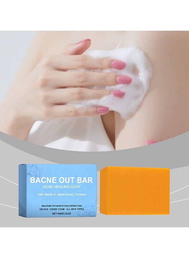 OceAura Bacne Out Bar, Acne Healing Soap With Turmeric Vitamin C & Alphaarbutin, Natural Exfoliating Cleanser For Back, Face, Chest, Shoulders, Tumeric Soap For Acne, Dark Spots, Hyperpigmentation, Smooth Skin, 100g - Image 2