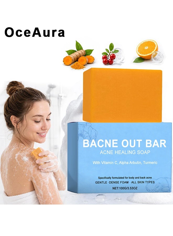 OceAura Bacne Out Bar, Acne Healing Soap With Turmeric Vitamin C & Alphaarbutin, Natural Exfoliating Cleanser For Back, Face, Chest, Shoulders, Tumeric Soap For Acne, Dark Spots, Hyperpigmentation, Smooth Skin, 100g - Image 1