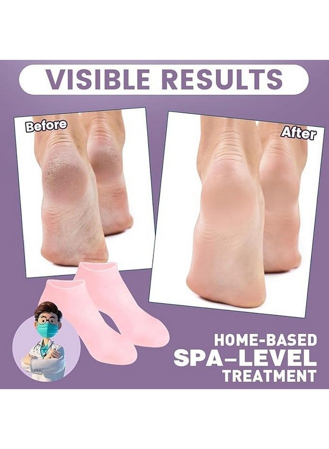 Silicon Heel Socks Heel for Crack Spa Gel Socks for Women and Men, Feet Protector Crack Heel Repair Socks with Moisturizing Natural Oil and Vitamin E (multicolored) (1 pair) - Image 5