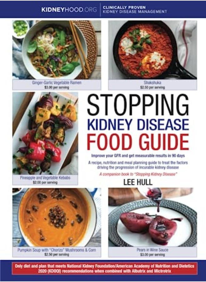 Stopping Kidney Disease Food Guide A Recipe Nutrition And Meal Planning Guide To Treat The Factors by Hull, Lee Paperback 