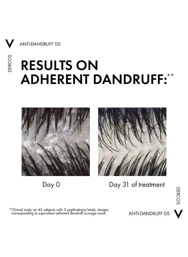 VICHY شامبو ديركوس المضاد للقشرة للشعر العادي إلى الدهني 200 مل + شامبو ديركوس المضاد للقشرة للشعر العادي إلى الدهني 200 مل - Image 4