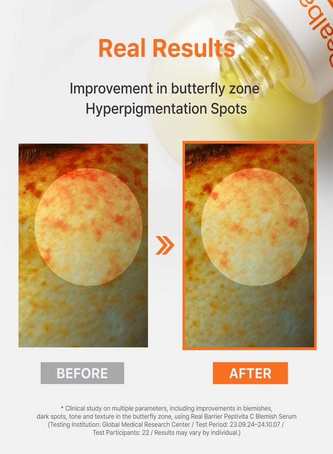 Real Barrier | Peptivita C Blemish Serum | Face Serum for Uneven Skin Tone & Smooth Texture | Vitamin C Face Care for Sensitive Skin | Facial Skin Care Products | Korean Skincare | 1.01 fl oz (30ml) - Image 4