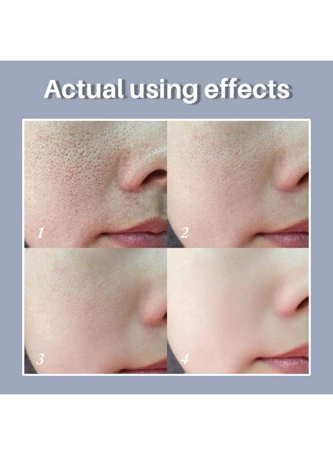 لان بينا مصل العناية بالبشرة المسامية، جوهر الوجه، يقلل من المسام الواسعة لتضييق المسام، تقليص المسام + تخفيف الجفاف + التحكم في الزيت، ثبات + ترطيب (عبوة جديدة) - Image 4