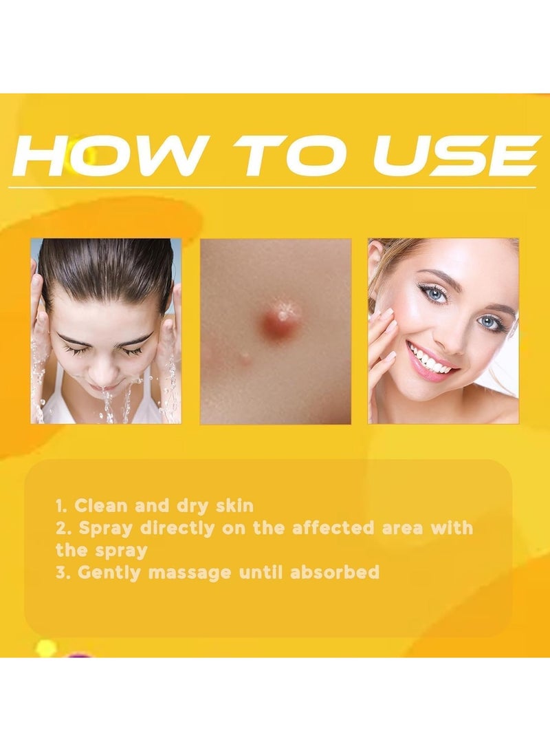 ساوث مون بخاخ العناية بالثآليل بخاخ العناية بإزالة الثآليل إزالة الثآليل وإزالة الثآليل الجلدية بخاخ إزالة الثآليل للبشرة الناعمة 20 مل - Image 3