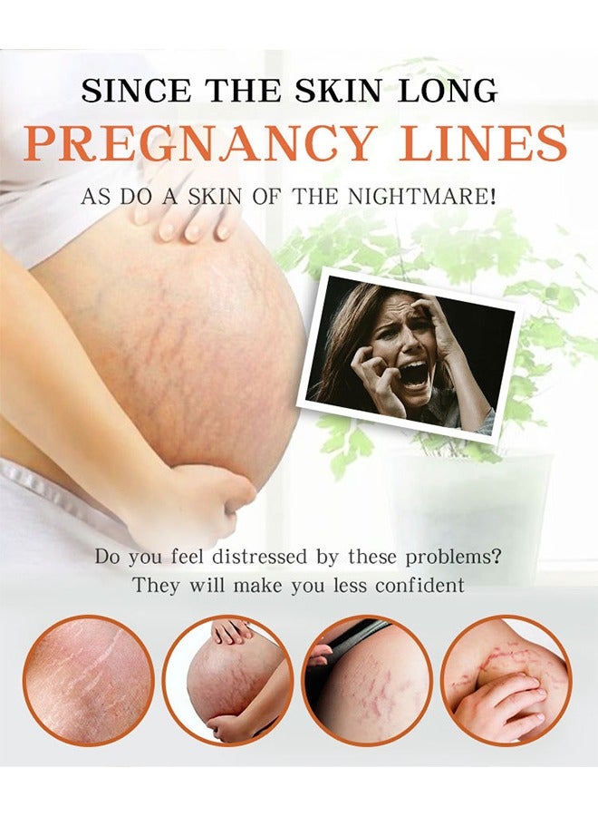 AuQuest Stretch Marks Removal Cream, Scar Removal Cream, Natural Plant Nutritional Glycerin Extract Formula, Stretch Mark Prevention, Old Scar Body Moisturizer - Image 4