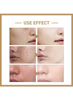 EELHOE Rice Toner, 77.78% Rice Extract, Effectively Replenish Nutrients Improve Dryness Soften Cuticles Minimize Poreslighten Acne Scars Soothe And Repair Skin 150ml  - Image 5