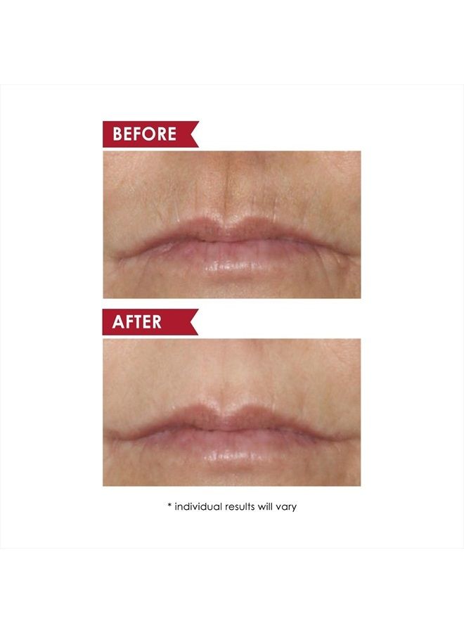 Dermelect Smooth Upper Lip Professional - Anti Aging Cream with Hyaluronic Acid, Collagen, Retinol, Brightening & Smoothing Treatment for Lip Lines, Smile Lines, Discoloration, Lipstick Bleeding 0.5 o - Image 3
