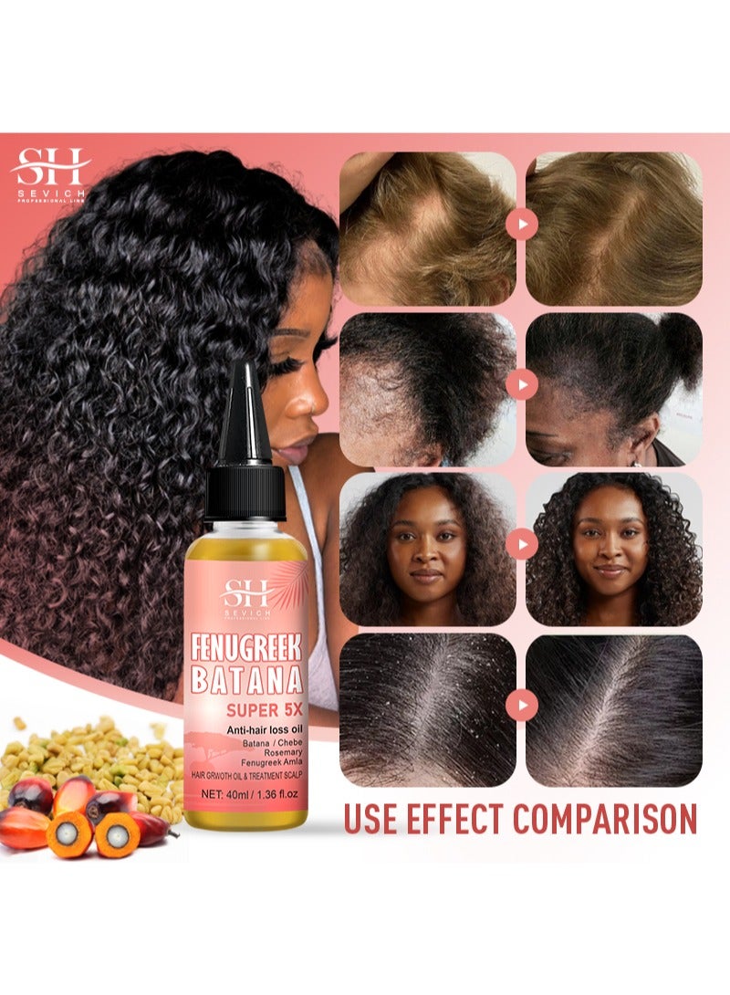 Sevich Fenugreek Batana Super 5X Anti-Hair Loss Oil，5X Rapid Hair Growth Oil with Batana Chebe Rosemary Fenugreek and Amla Oil Hair Growth Oil and Scalp Treatment Super 5 in 1 Oil Anti Hair Loss Oil and Hair Regrowth Scalp Treatment Oils（40ml） - Image 5