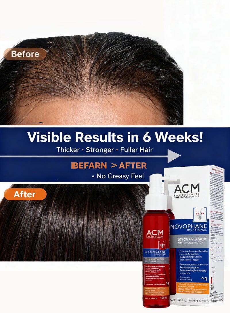 ACM Novophane Anti Hair Loss Lotion,Strengthens Stimulates Hair Growth,Leave-In Scalp Treatment for Thinning Hair,Suitable for Men & Women,100ml - Image 5